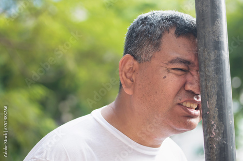 unlucky careless old senior man hitting his head with iron pole; concept of head injury, head accident, brain injury, brain lesion, memory loss, amnesia; asian senior man model