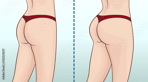 Female buttocks before and after workout. Buttock muscles.