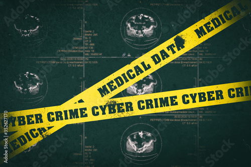 Banner mit Medical Data und Cyber Crime bei Diebstahl oder Hackerangriff