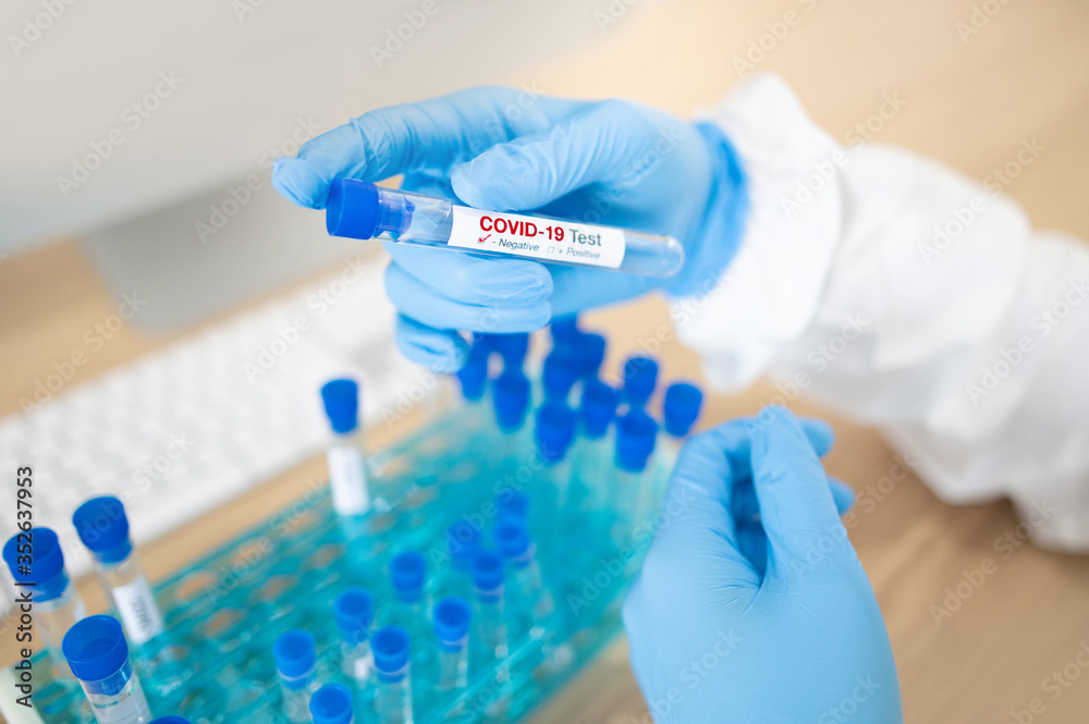 Medical scientist hand with blue sterile rubber gloves holding COVID-19 test tube in hospital laboratory. Male doctor or physician getting result of Coronavirus case. 2019-nCoV lab test concept Medical scientist hand with blue sterile rubber gloves holding COVID-19 test tube in hospital laboratory. Male doctor or physician getting result of Coronavirus case. 2019-nCoV lab test concept
