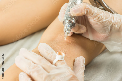 Foto Scar camouflage with clinic rotative device
