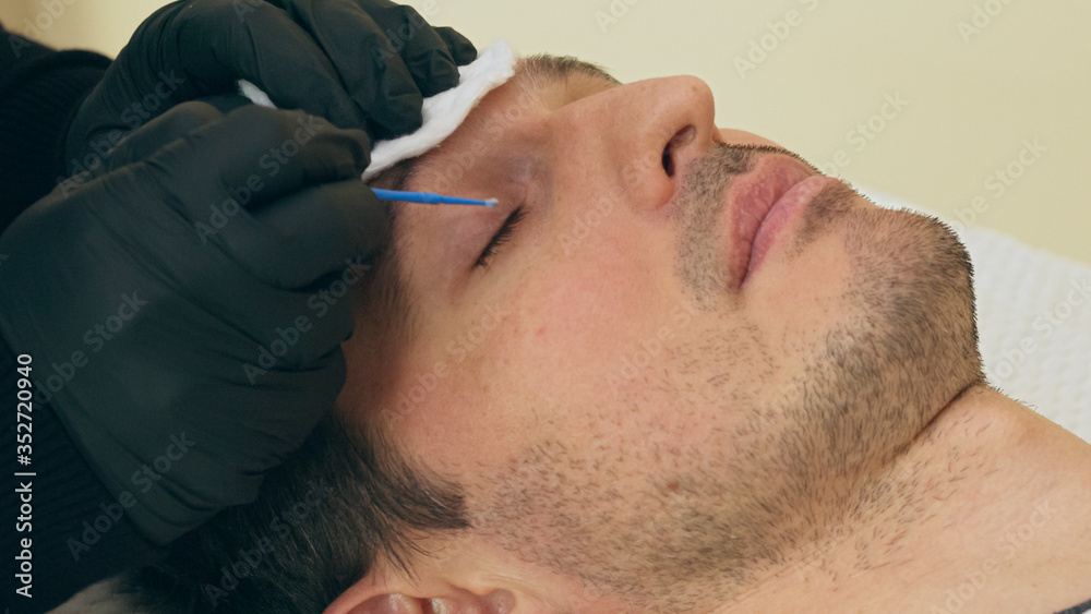 Obraz premium Close up of cosmetologist preparing man for the eyelash extension procedure. High quality close-up of a man laying on a couch during the esthetician lash treatment.