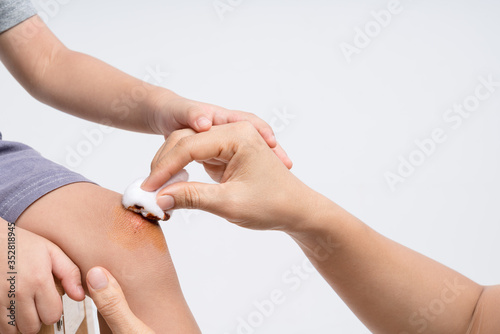 Billede på lærred Mother hand holding cotton wool soaked with Povidone iodine for do basic first t