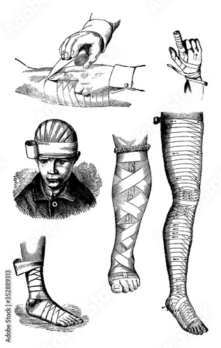 Wound Dressing Bandages, vintage illustration.