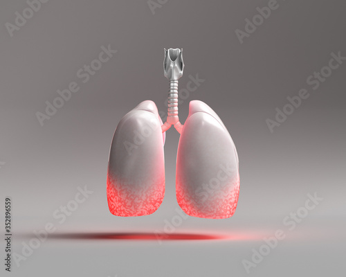 Lung - Lower Respiratory Tract Infection