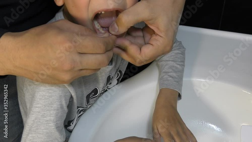 Father is trying to tear out his son’s tooth, dad pulls out the baby’s milk tooth at home