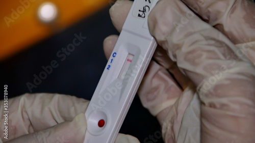 Unfocused, Blurry selective focus and noise image COVID-19 virus disease test, Coronavirus crisis, global pandemic outbreak, rapid strep test (RST) kit, quick antigen detection testing (RADT)