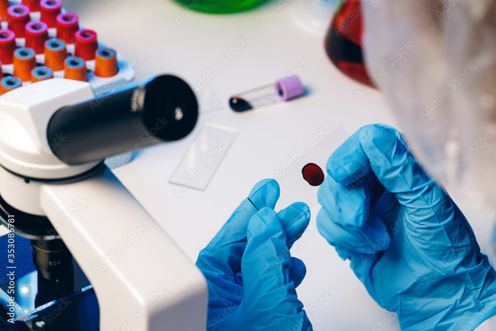 Hands of a laboratory worker doing blood test