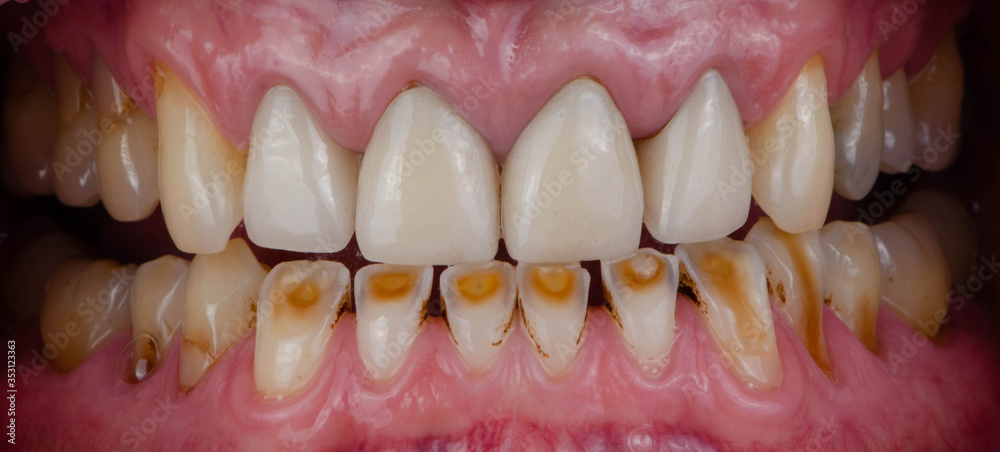 The various style of teeth The various style of teeth