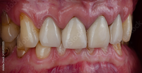 The various style of teeth photo