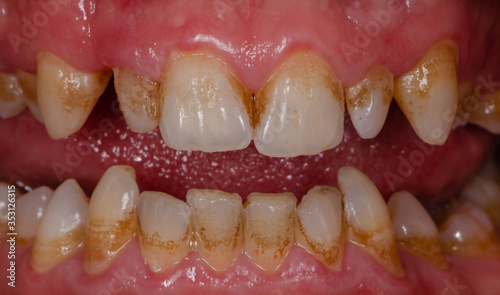 The various styles of intra-oral photograph