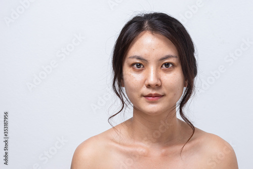 Portrait of women before facial face care, Asian young girl face skin treatment. Fresh skin, No makeup.
