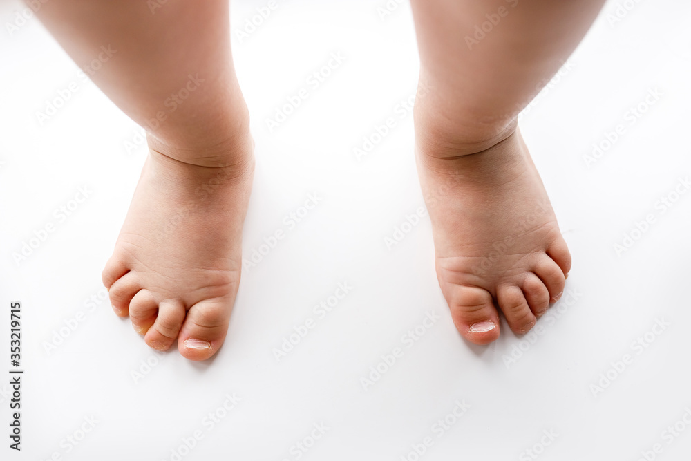 Naked bare legs of a small child close up on a white background Naked bare legs of a small child close up on a white background