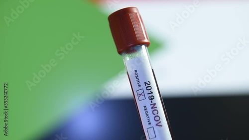 Corona virus or Covid-19 in Sudan , sample blood tube with Sudan flag on background