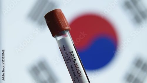 Corona virus or Covid-19 in south Korea, sample blood tube with south Korea flag on background