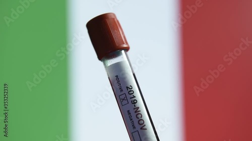 Corona virus or Covid-19 in Italy , sample blood tube with Italy flag on background