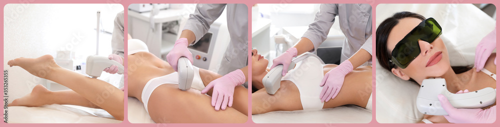 Collage with photos of woman undergoing laser epilation procedure. Banner design