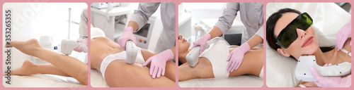 Collage with photos of woman undergoing laser epilation procedure. Banner design photo