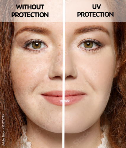 Young woman without and with sun protection cream on her face, closeup