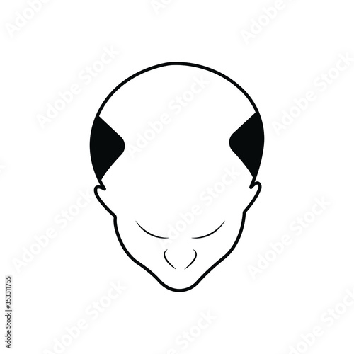 Hair loss color icon. Balding. Declining testosterone. Low T level sign. Alopecia, baldness. Men aging. Isolated vector illustration