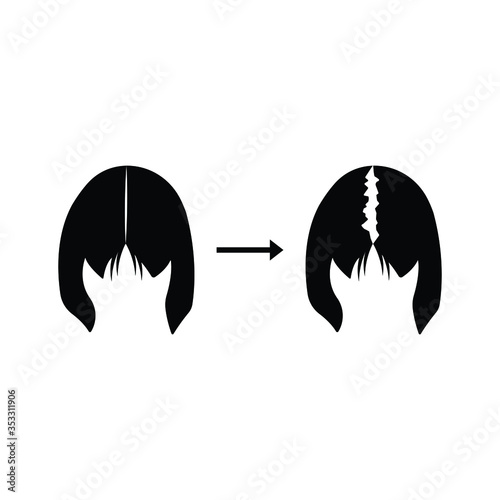 women hair loss icon. Woman serious hair loss problem for health care shampoo and beauty product concept. eps 10