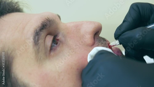 High quality close-up 4k slow motion video of a man laying on a couch during the esthetician lips treatment. Male permanent make-up service.