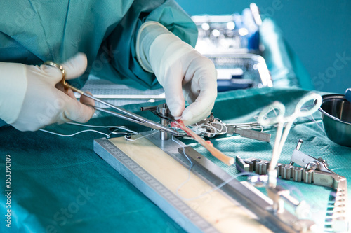 Sehnenvorbereitung Kreuzbandoperation