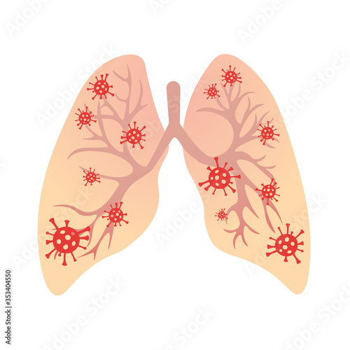 Viruses in lungs vector illustration. Concept of viral respiratory infection, coronavirus, bronchitis.