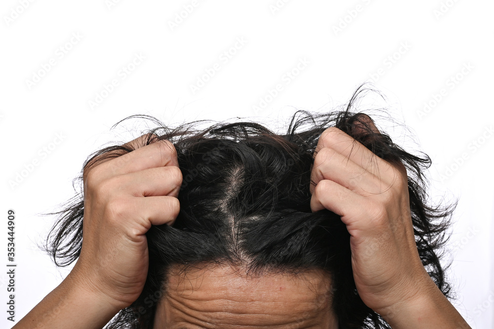 Man is checking hair, dandruff problems and face skin problems close up head on white background Man is checking hair, dandruff problems and face skin problems close up head on white background