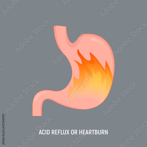 Acid stomach burn gastritis icon. GERD acidity stomach reflux heartburn ache