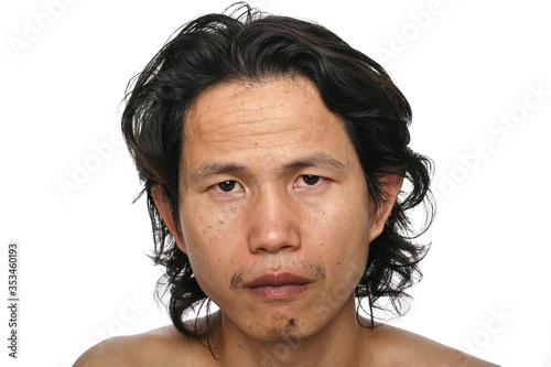 Foto Facial Close up: Asian men aged 35-40 years with wrinkles Crows feet, lack of sk