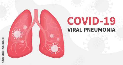 Flat vector illustration of human lungs under viral pneumonia and covid. Coronavirus in your infected organs, close up view on virus cells, detail outline of anatomy isolated.