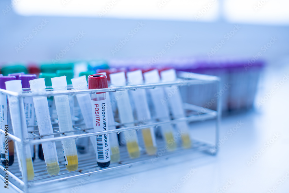 Corona-19 Virus Diagnostic Laboratory, select focus Corona-19 Virus Diagnostic Laboratory, select focus