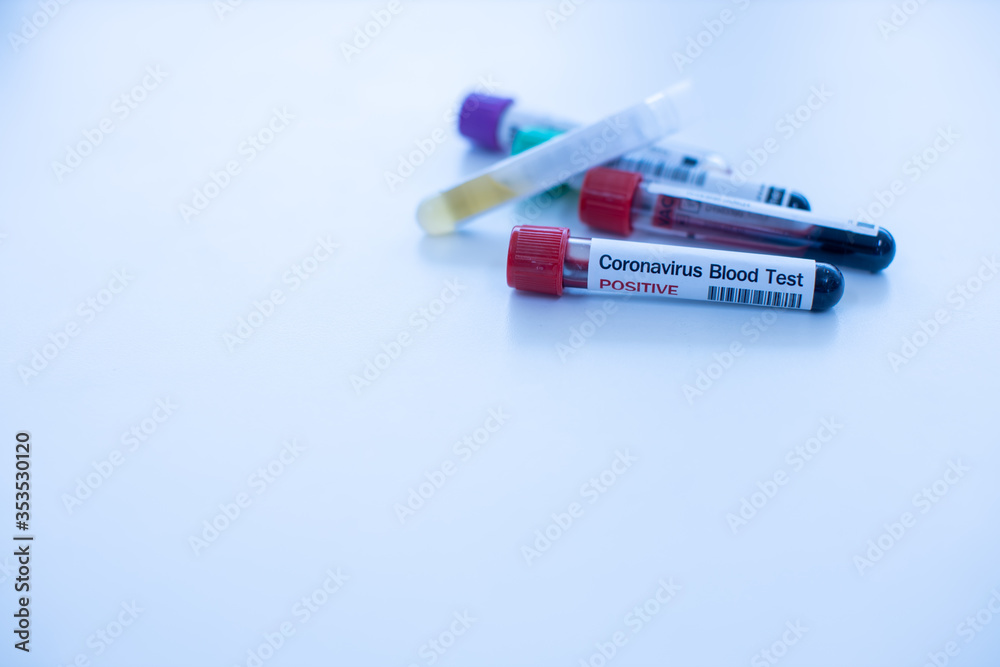 Obraz premium Corona-19 Virus Diagnostic Laboratory, select focus