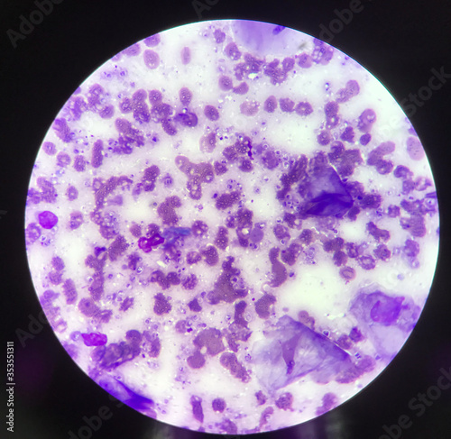 Budding yeast cells binary fission cells in smear. photo