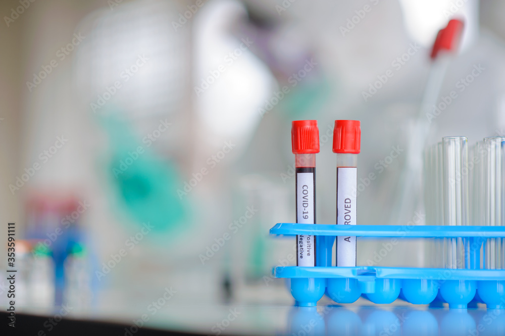 Doctor, scientist, researcher Currently studying and analyzing blood samples of corona virus patients 2019 for use in research and experiment in medicine for treatment of patients in hospitals.