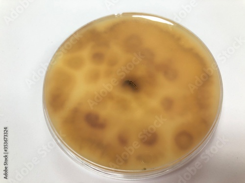 Microsporum gypseum on Sabouraud dextrose agar at 25°C, 10 day photo