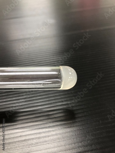 positive , tube coagulase test : staphylococcus aureus  photo