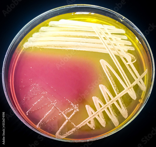 staphylococcus aureus growth on Mannitol salt agar 24h, incubate at 37 celcius photo