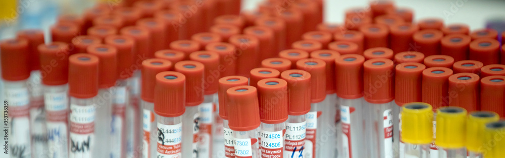 A medical laboratory takes a blood sample and tests for covid A medical laboratory takes a blood sample and tests for covid