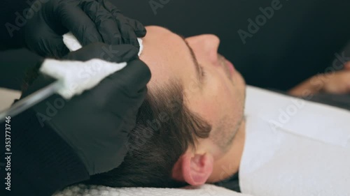 High quality close-up 4k slow motion video of a man laying on a couch during the esthetician hair treatment. Male tricopigmentation service. Scalp micropigmentation treatment. Trichopigmentation 