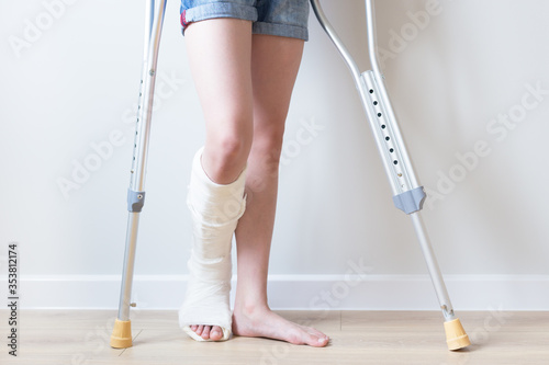 Close-up of children's feet, one leg is broken and in a cast, next to crutches. Light background. Selective focus.