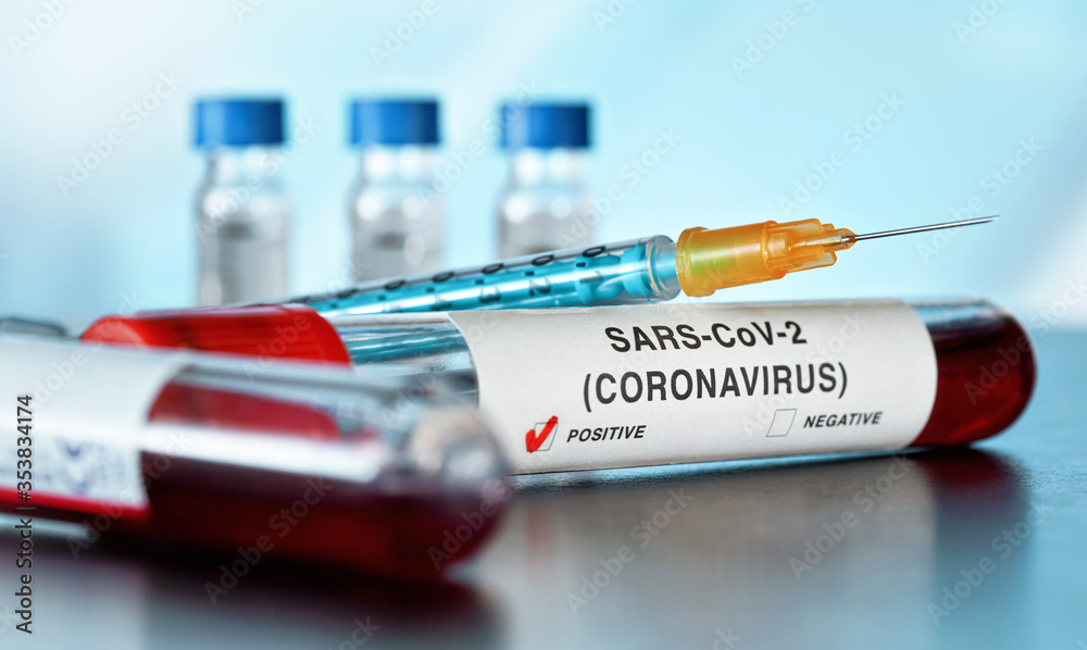 Naklejka premium Sample vial with blood, label says coronavirus test, positive result. Blurred laboratory equipment background. Covid-19 testing during outbreak concept