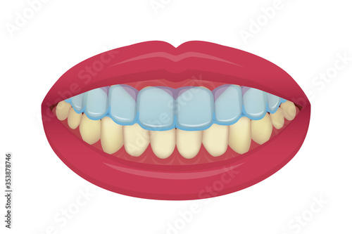 Teeth whitening at home vector illustration / no text