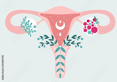 Fényképezés Women health - Floral Infographic of Polycystic ovary syndrome