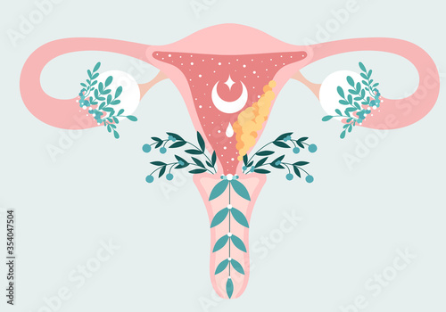 Women health. Floral Infographic of Endometrial Cancer - Carcinoma. Patient-friendly scheme of Gynecological cancerous tumor. Oncology in Female - Neutral medical diagram uterus and appendages