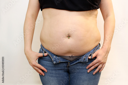 a plump woman in jeans that are too small for her. Excess weight