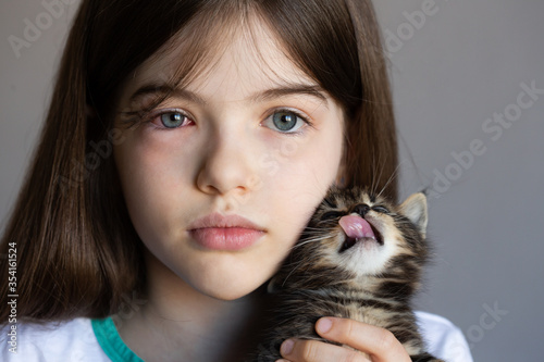 little girl holds a kitten in her arms. The child is allergic to cats, red eyes.