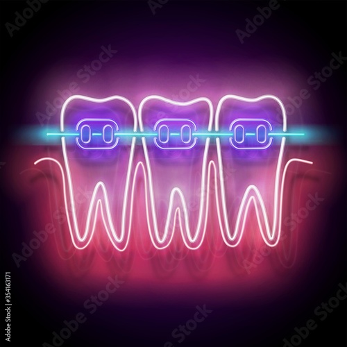 Glow Dentition with White Teeth and Braces