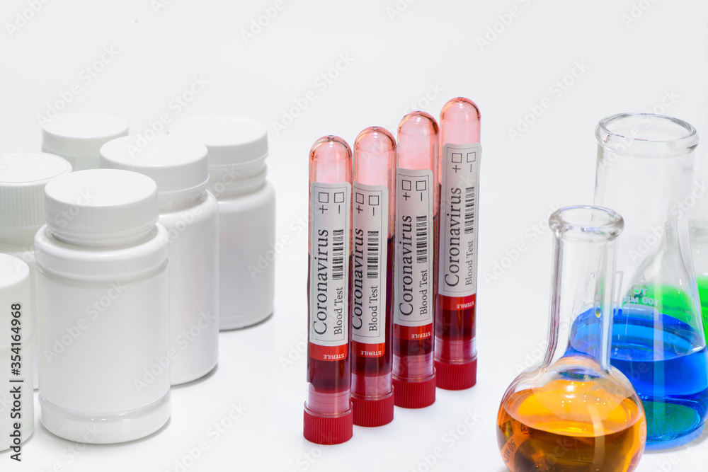Coronavirus test laboratory sample of blood and laboratory flasks